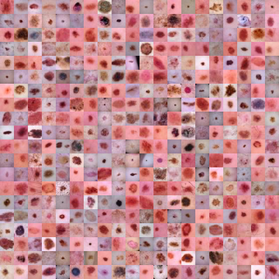 <PIL.Image.Image image mode=RGB size=560x560>